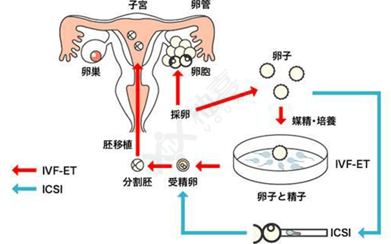 囊胚移植着床过程