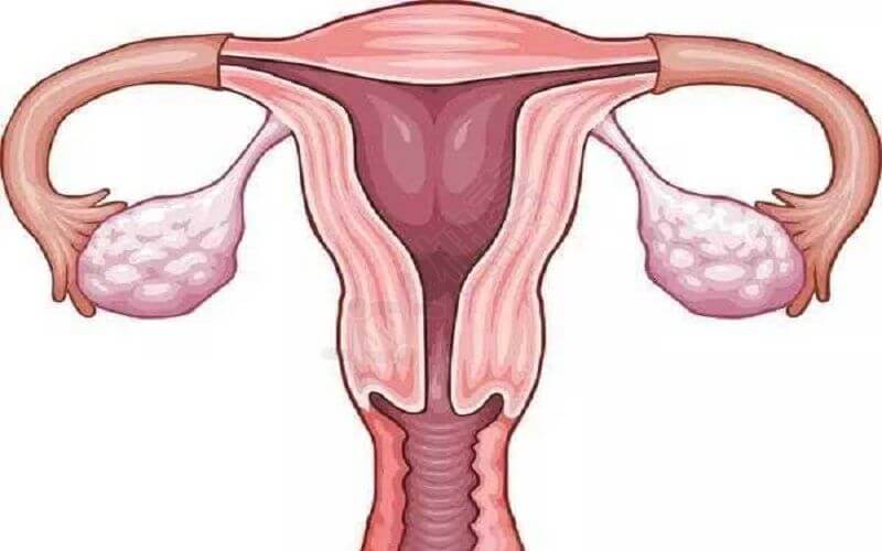 超长方案减少卵巢问题的生成
