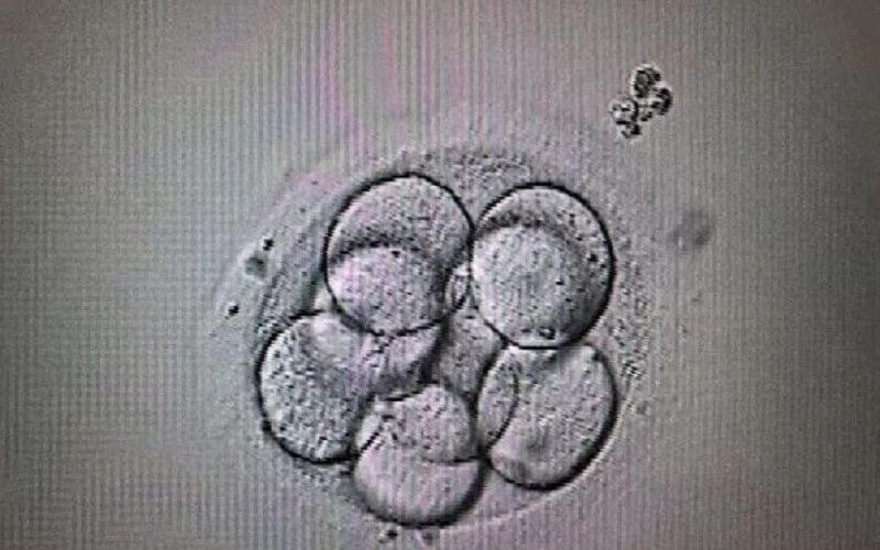 囊胚等级无法判断其性别