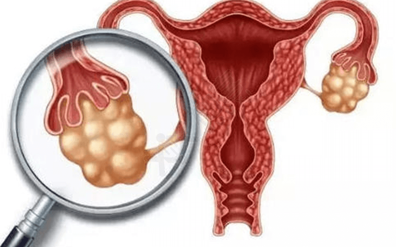 子宫疾病可以采取宫腔镜手术治疗