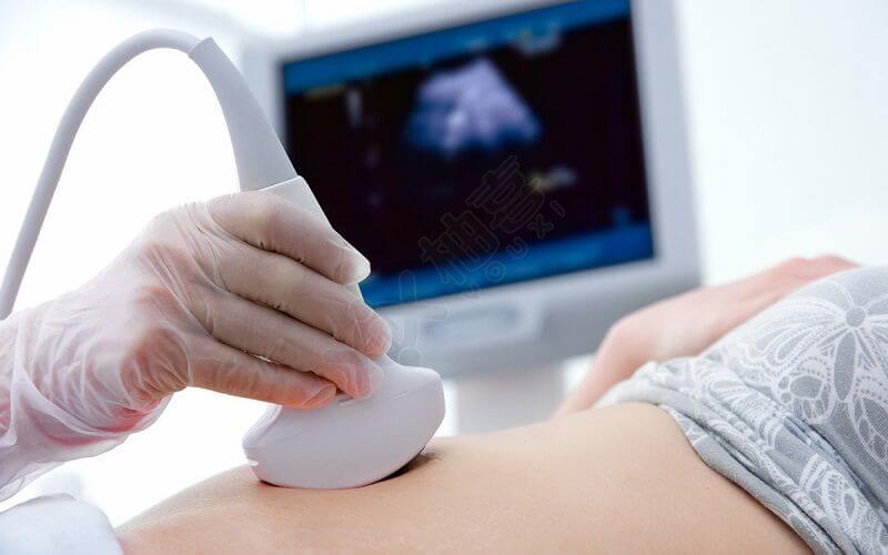 超声检查胎停育的女性
