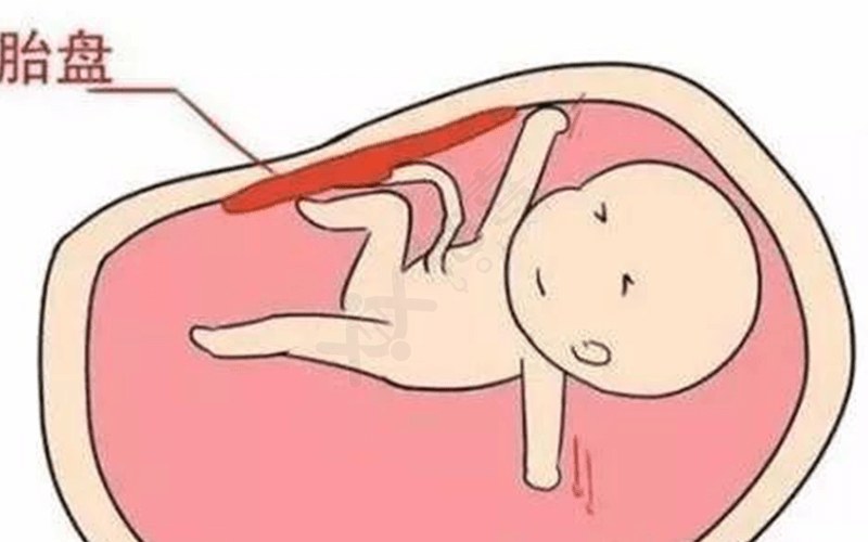 胎盘的血栓会对胎儿造成不良影响
