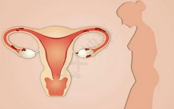 卵巢囊肿怀孕顺产会让你多挨一刀，剖宫产可以一举两得