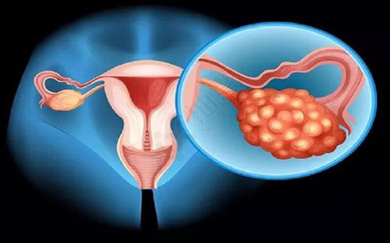 大龄女性生育能力降低的原因是卵巢情况不良