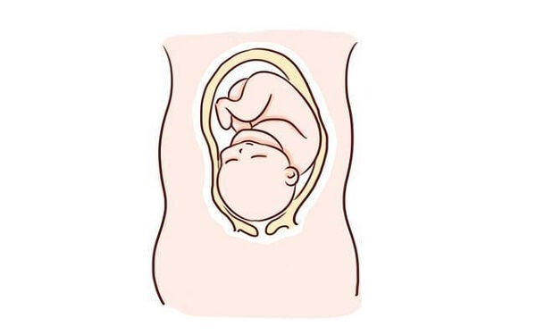 建议收藏的5个纠正方法，等孕晚期胎位不正可就晚了！