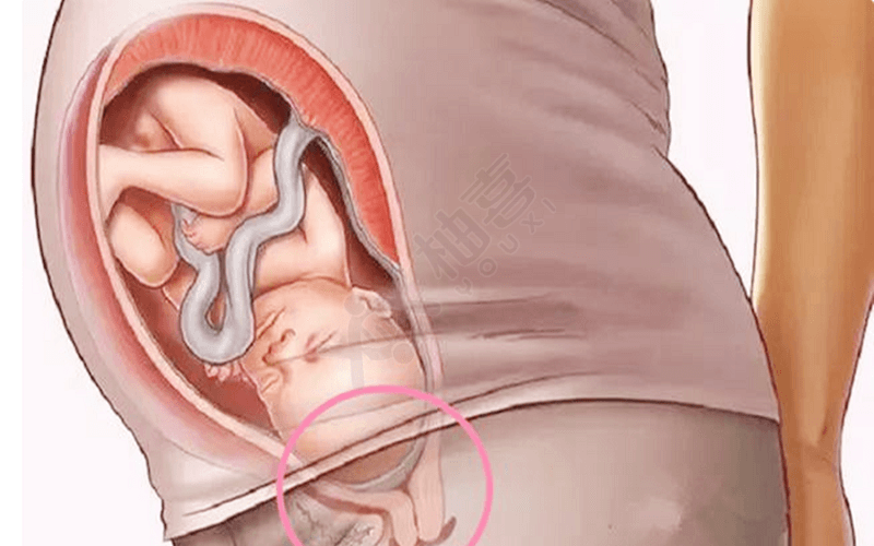 胎儿入盆预示到待产期了