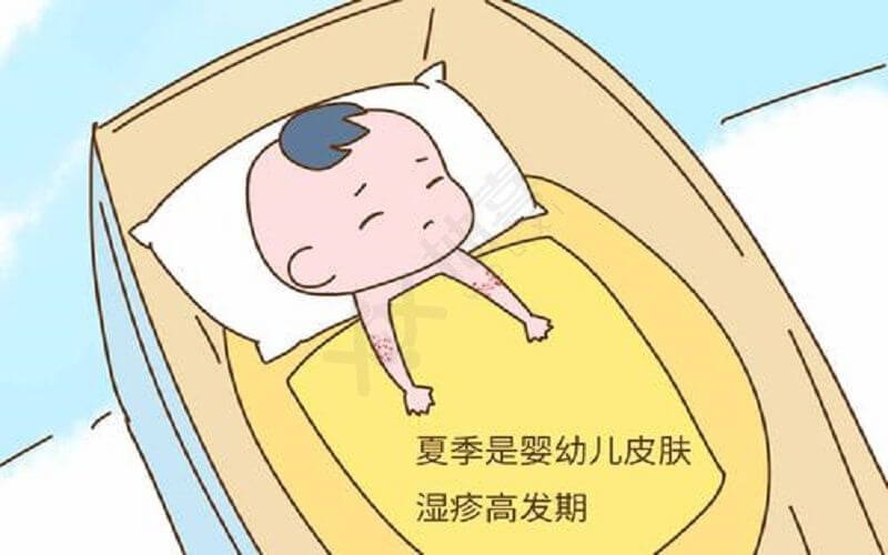 夏季容易患上湿疹