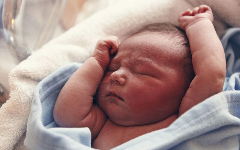 新生儿黄疸宝宝会出现嗜睡的症状