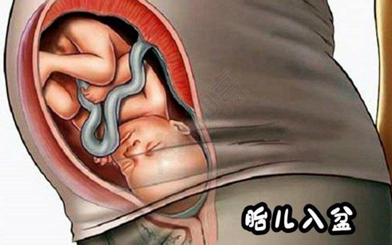 胎儿入盆表示孕妇进入待产期
