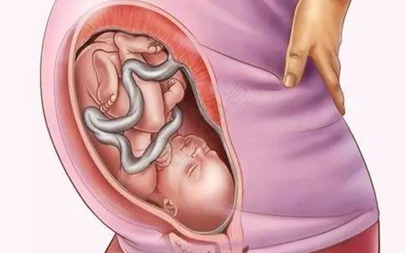 胎儿大小会影响入盆时间早晚
