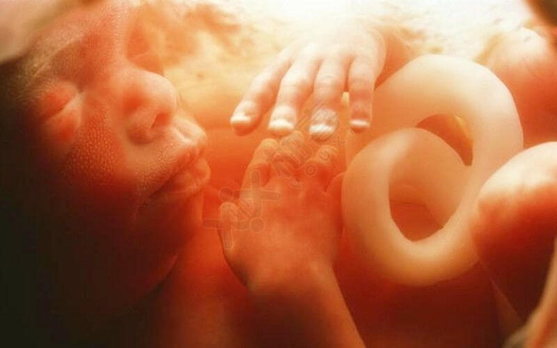 畸形精子受孕后容易导致胎儿畸形