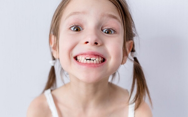 儿童想要吃嘛嘛香，换牙期就必需注意这5大事项