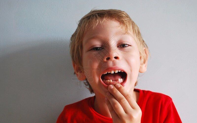 换牙是儿童成长的必经阶段