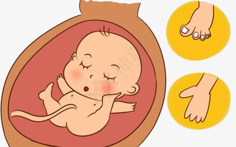 妊娠糖尿病的危害有造成胎儿畸形
