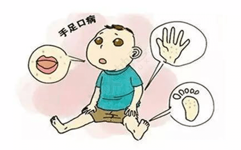 手足口病是一种小儿急性传染病