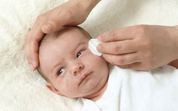 新生儿泪囊炎必须及时治疗，5种方法赶紧学起来