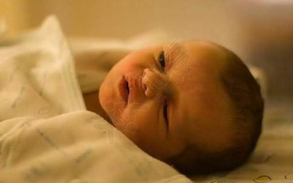 新生儿黄疸退的慢小心病理性原因，5种方法快速消退
