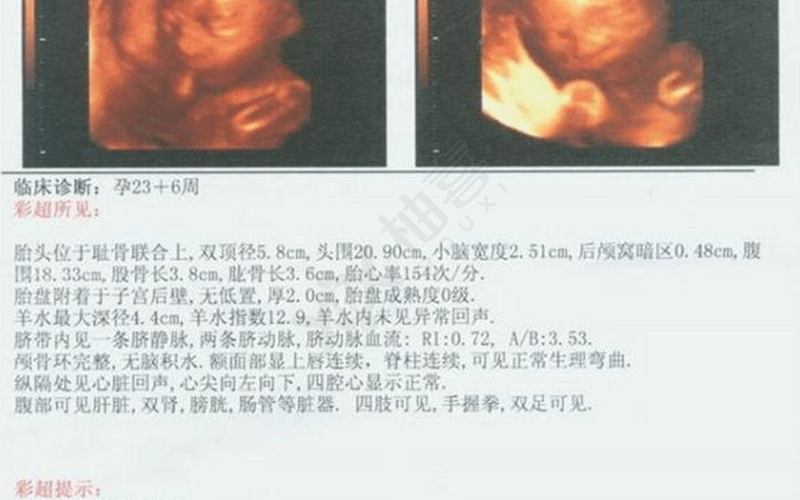 怀孕B超报告单上有很多数据