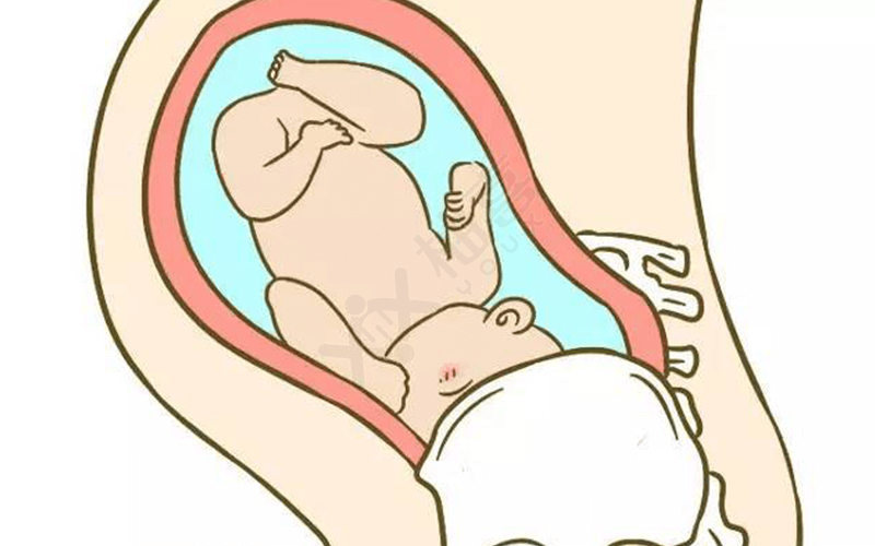 胎位roa是什么胎位图片图片