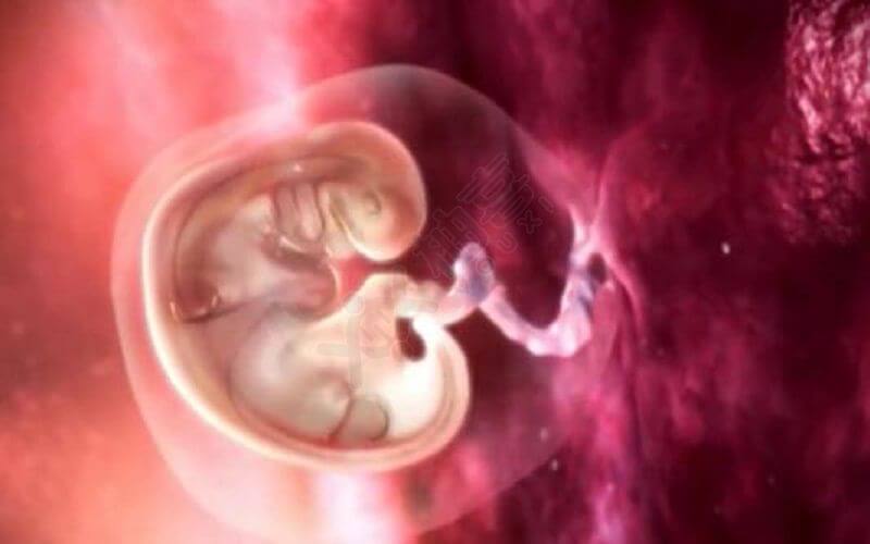 胎儿畸形图