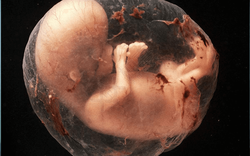 做完造影后当月怀孕胎儿有畸形的风险
