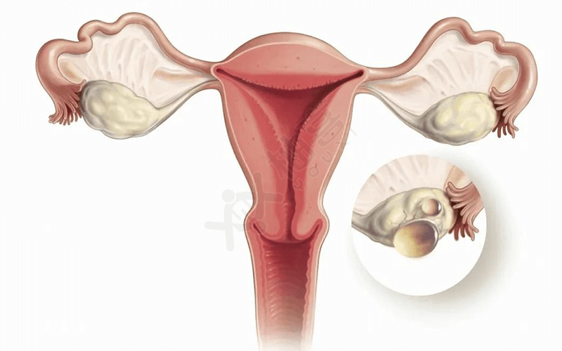 切除的卵巢的女性会老得很快