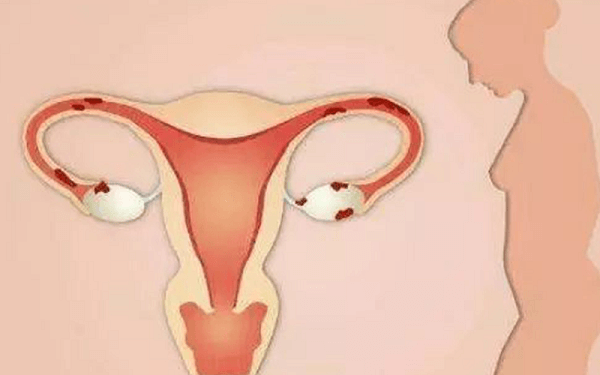 子宫内膜薄能否生孩子看情况，太薄怀孕很危险