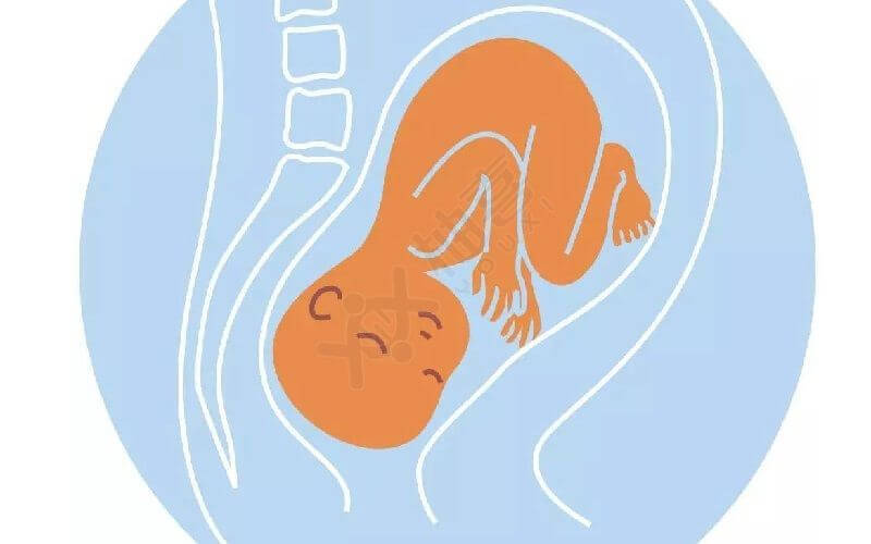 孕妇枕后位调整姿势图图片