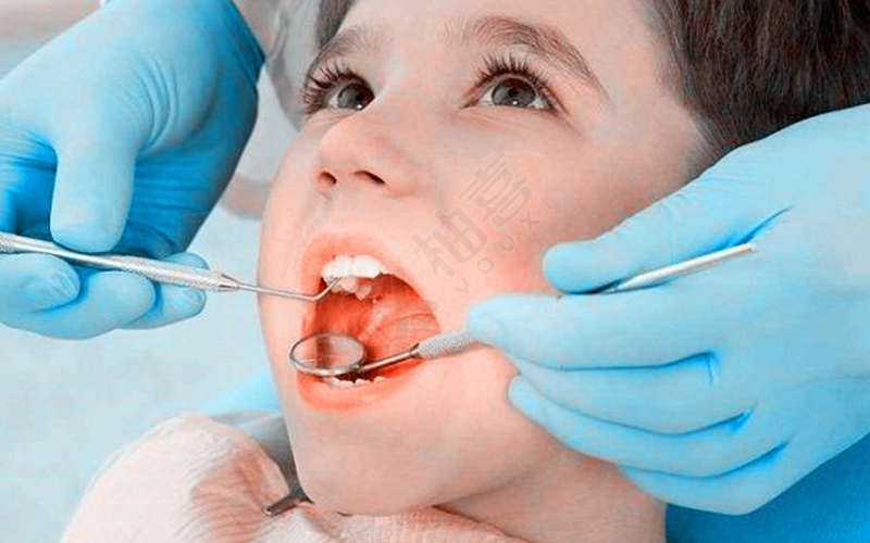 儿童换牙顺序错误会导致错颌畸形