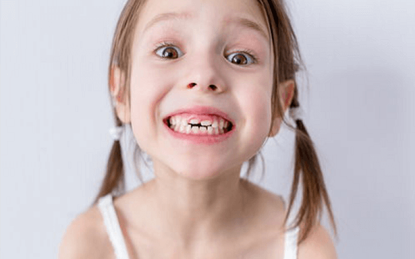 一幅换牙顺序图可辨别儿童牙齿是否正常，家长们快收藏!