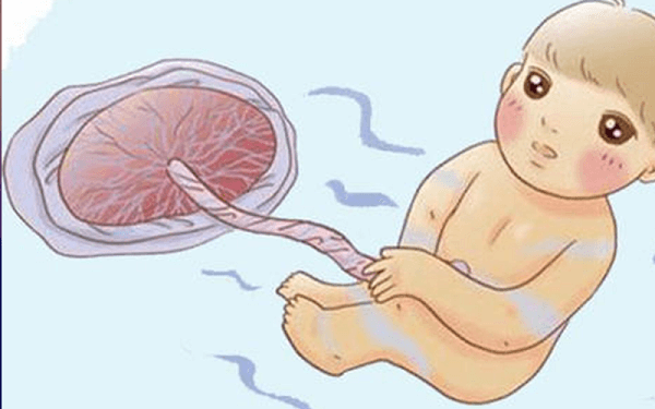 球拍状胎盘的孕妈要注意了！影响胎儿、顺产可不是小事