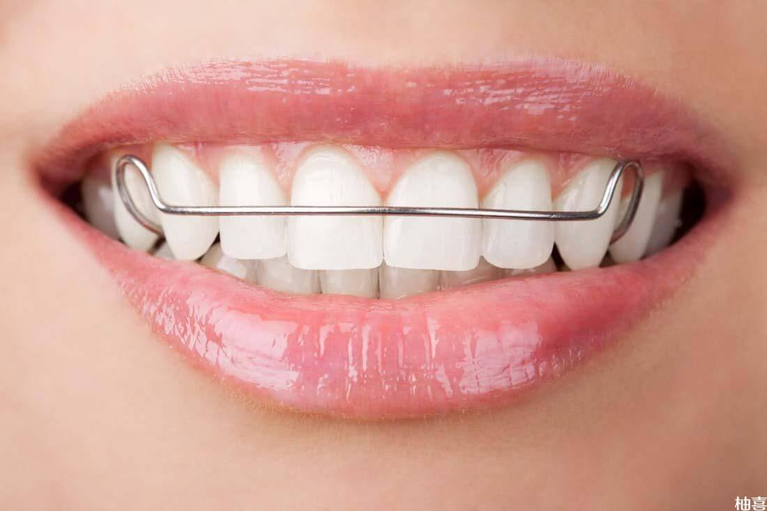 小孩带牙套可能影响牙齿健康