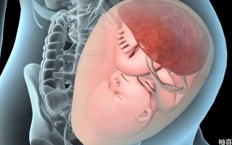 胎儿横位的分娩方式