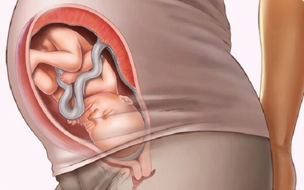 胎儿横位正常吗？孕中期、孕晚期得分开说！