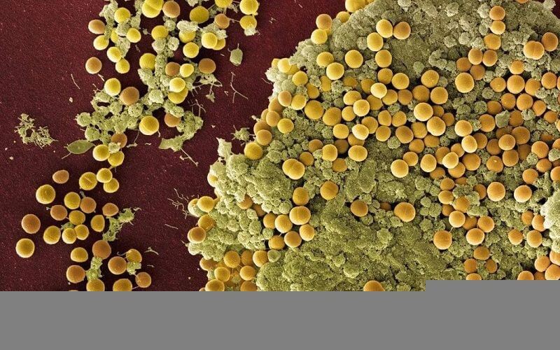 金黄色葡萄球菌图片