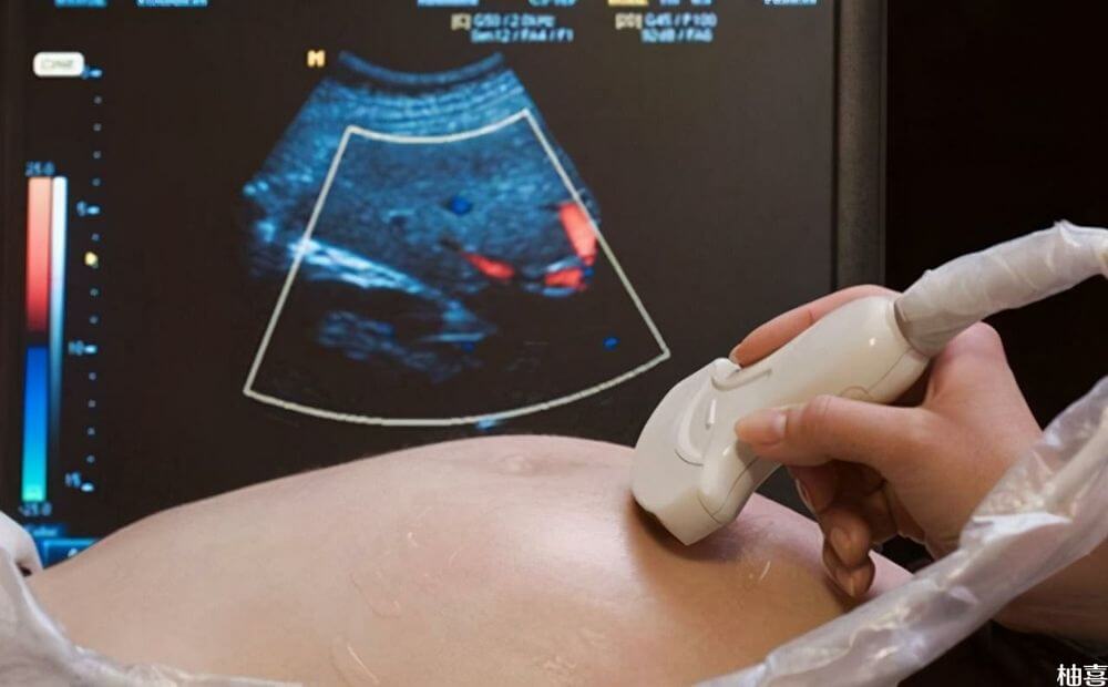 怀孕的35-40天可以做B超检查孕囊