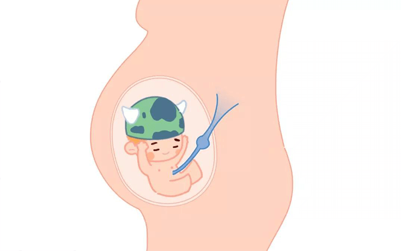 肚子里的胎儿位置不正