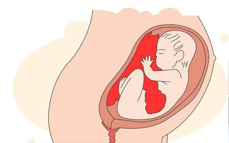 胎儿后壁