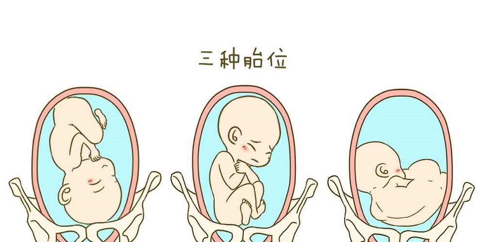 孕妇常见三种胎位图