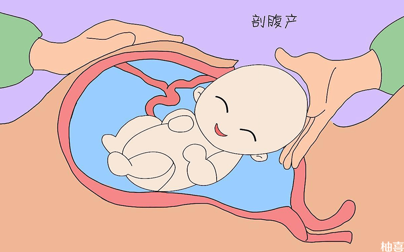 前置胎盘剖腹产时间