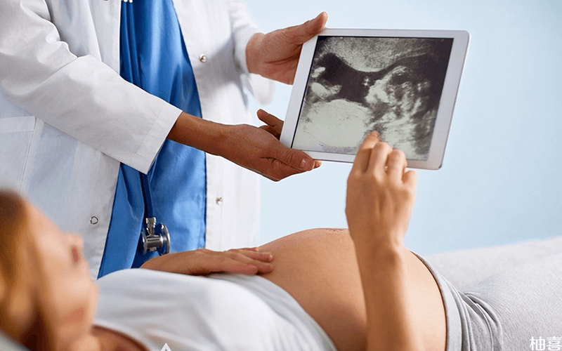 高龄孕妇产前诊断非常有必要