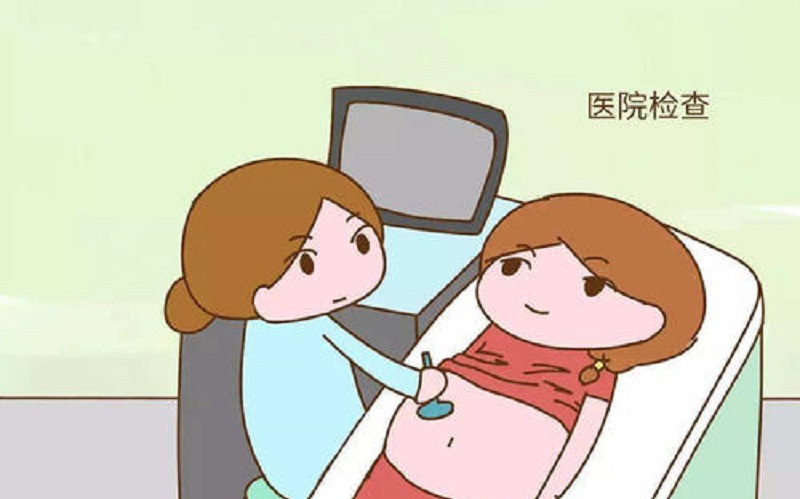 胎儿电子监护，超声检查图
