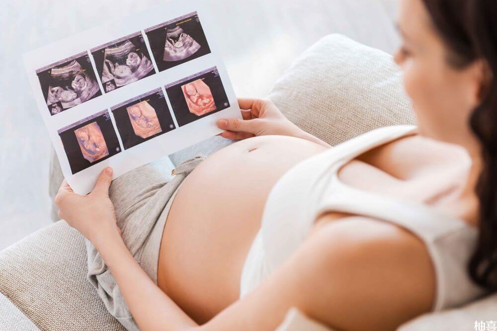 三维彩超能够科学的看出胎儿性别