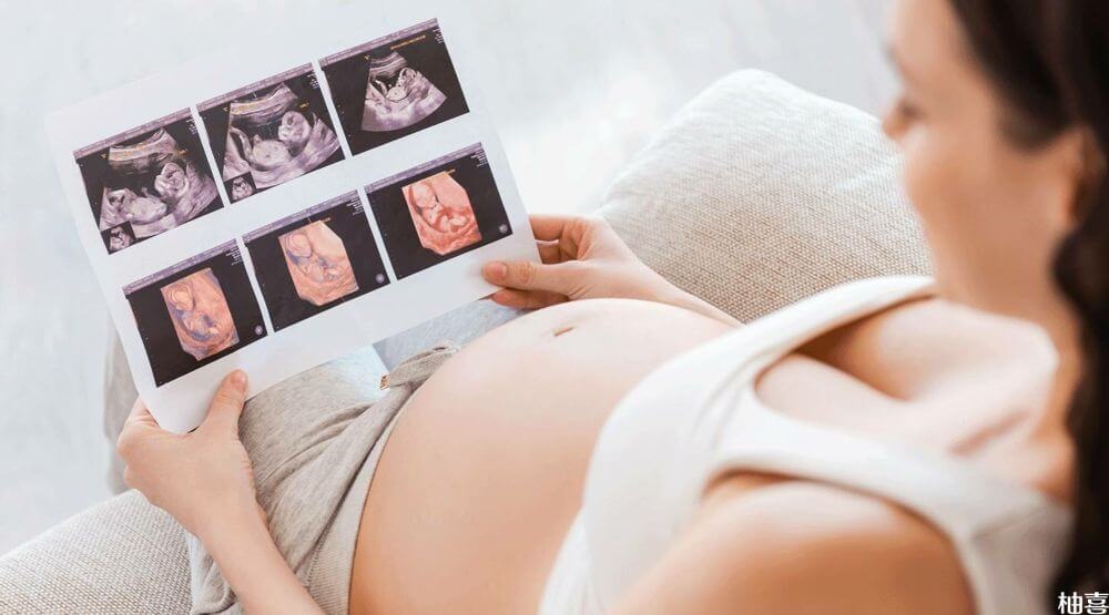 胎心监测主要是评估胎儿在宫内的安危情况