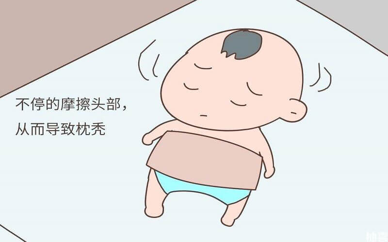 婴儿佝偻病睡觉姿势图