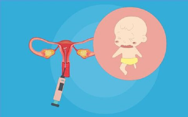 宁波妇儿医院生殖科做夫精人工授精多少钱？