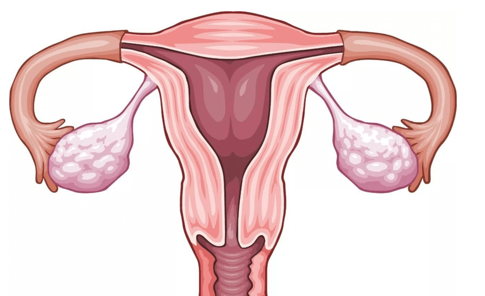 女性患者发病之前多有生殖系统炎症