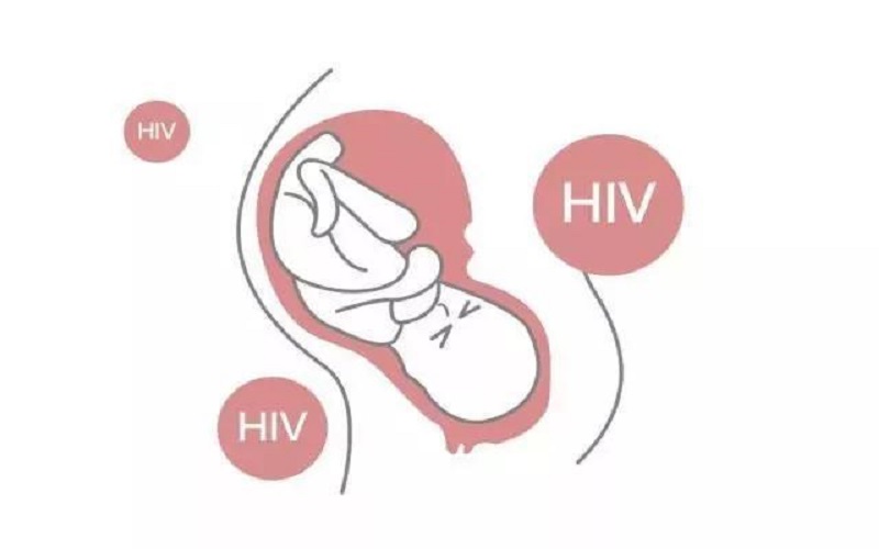 把携带艾滋病的精子分离出来得到健康的宝宝