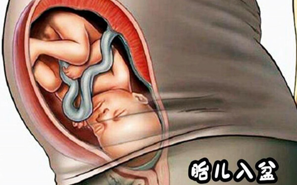 胎儿臀位也能入盆，孕妇临产前有3种强烈感觉
