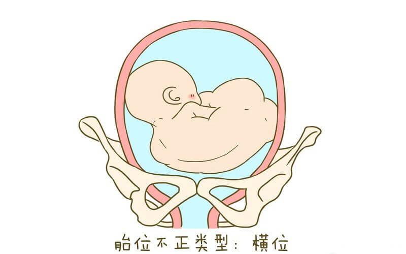 38周最快的胎儿横位转头位有哪些方法？